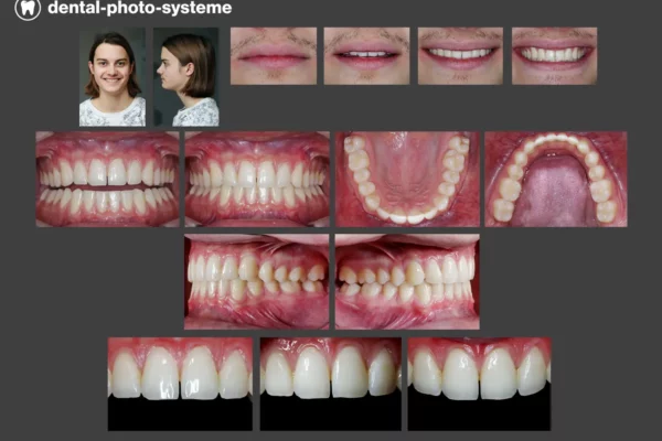 dental-photo-systeme_DentalKit