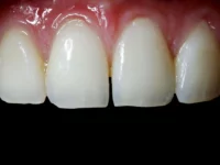 dental-photo-systeme_Kontrastor