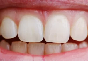 dental-photo-systeme_LateralKit