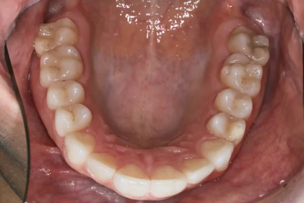 dental-photo-systeme_PIC_61