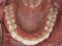 dental-photo-systeme_PIC_61