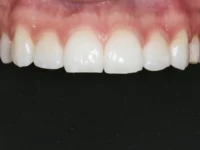 dental-photo-systeme_PIC_66